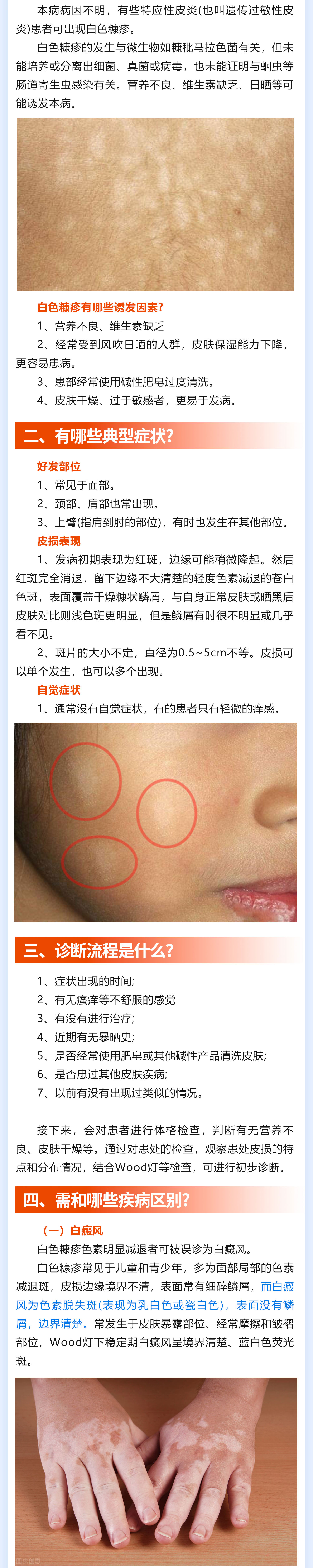 175期-白色糠疹_02(1).jpg