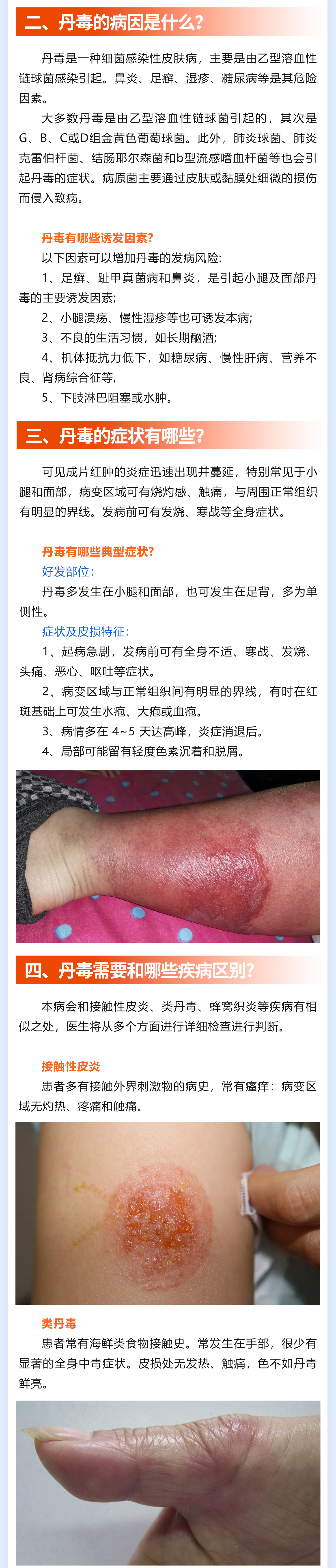 186期-丹毒_02(1).jpg