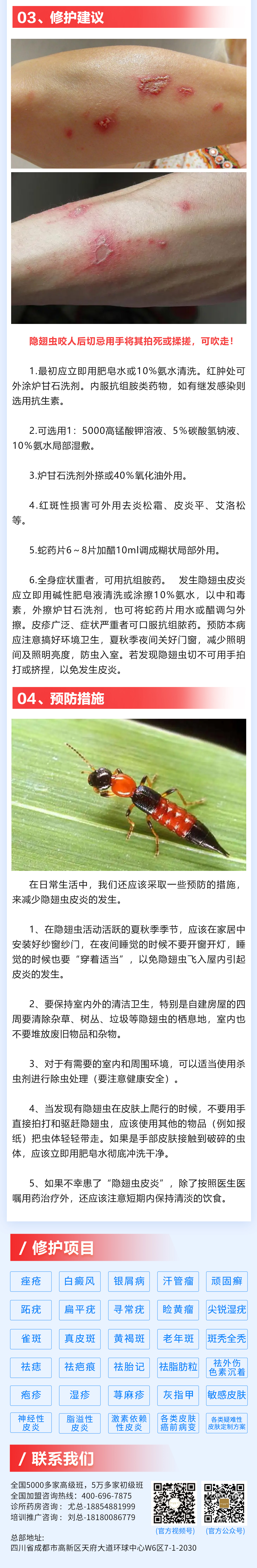 185期-隱翅蟲皮炎_03(1).jpg