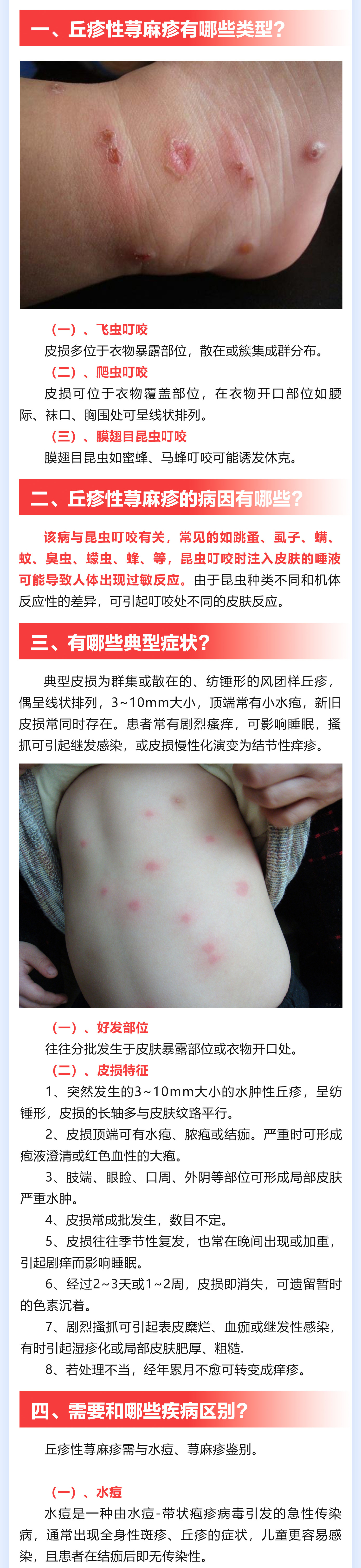 177期-丘疹性蕁麻疹_02(1).jpg