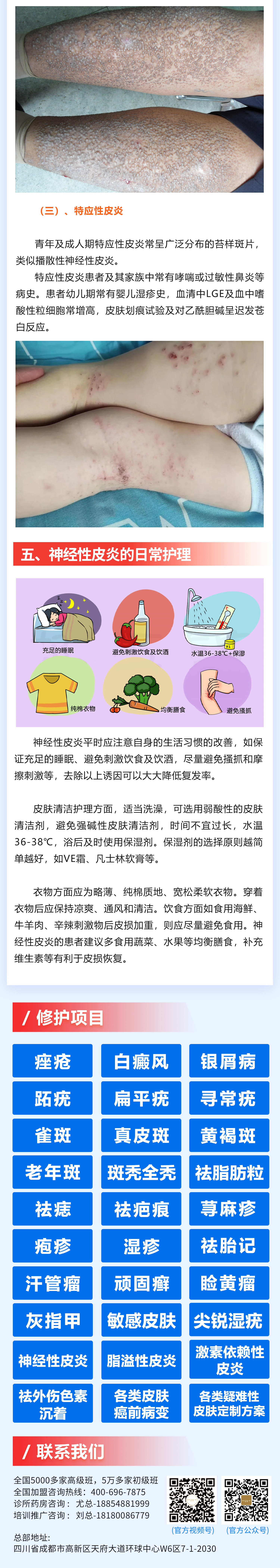 194期-神經(jīng)性皮炎_03(1).jpg