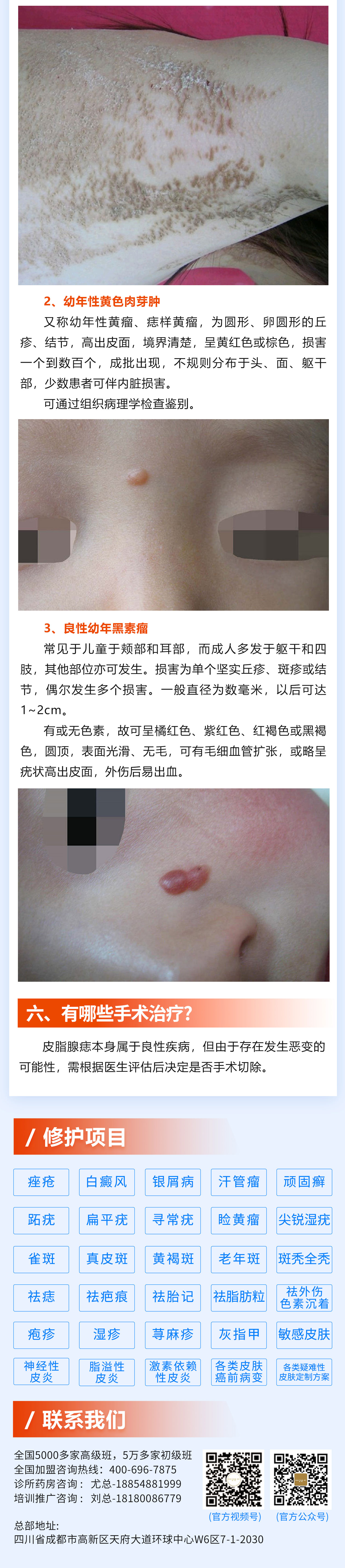 174期-皮脂腺痣_03(1).jpg