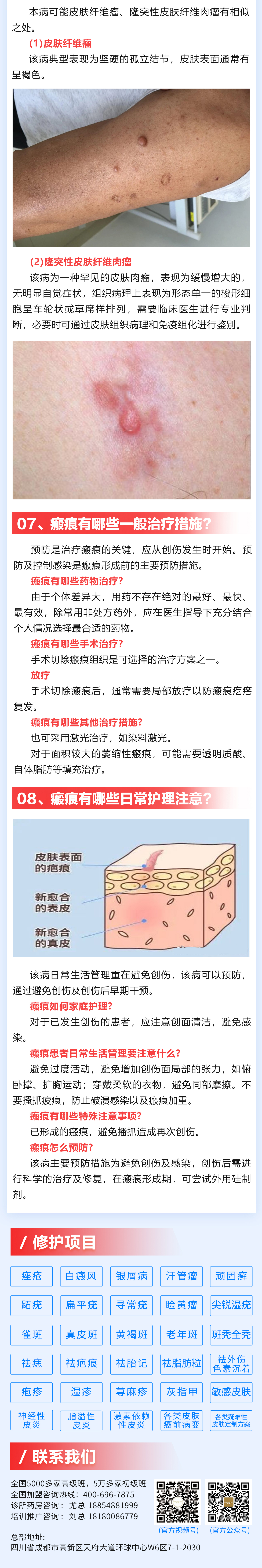 184期-瘢痕_03(1).jpg