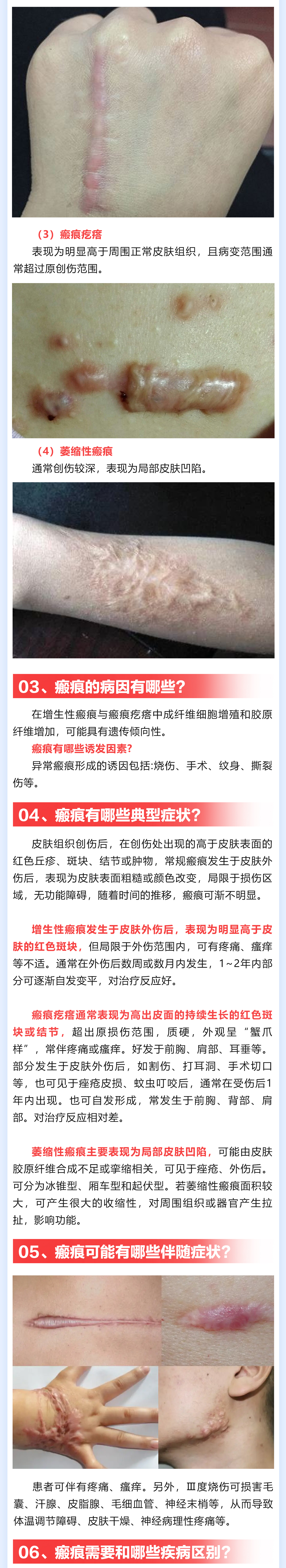 184期-瘢痕_02(1).jpg