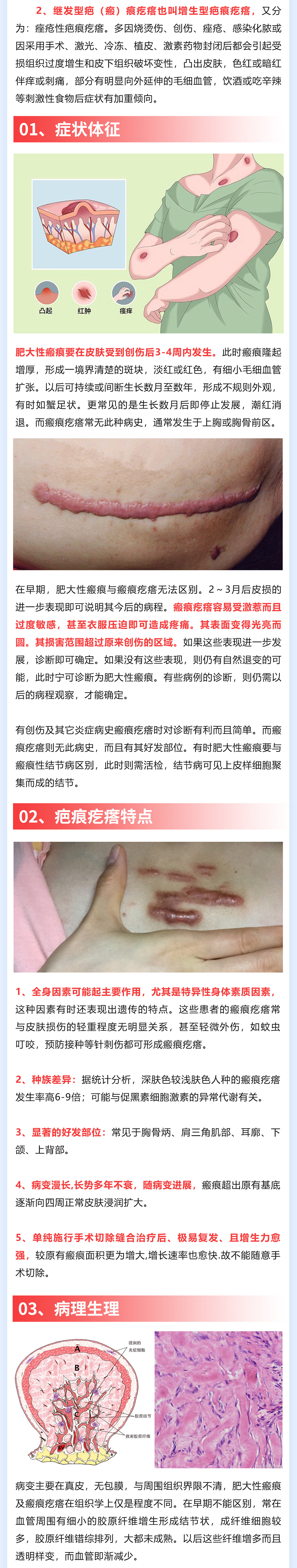 176期-瘢痕疙瘩_02(1).jpg